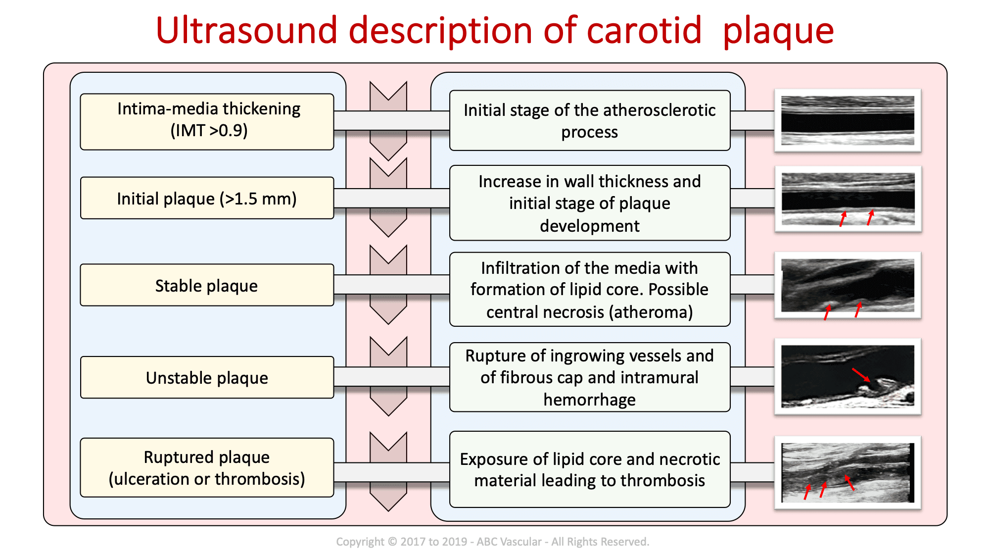 Carotid Course Info | Abc Vascular Inside Carotid Ultrasound Report Template