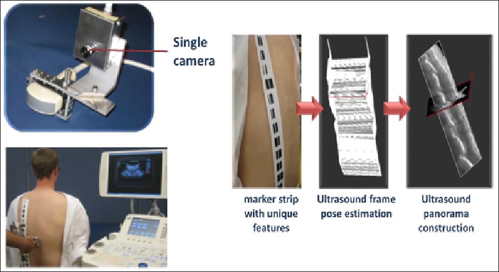 Carotid Ultrasound Report Template ] – Ultra Sound Report Throughout Carotid Ultrasound Report Template